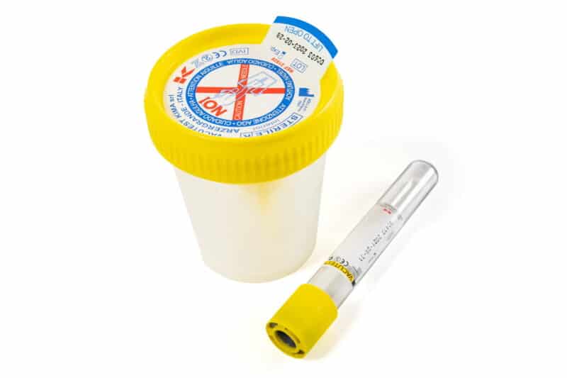 Pojemnik na mocz jałowy zestaw VACUTEST do pobierania próbki moczu 120 ml
